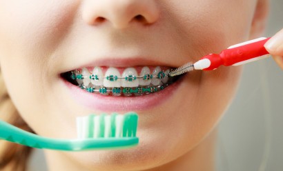 Cabinet orthodontie Liberation hygiene apareil dentaire