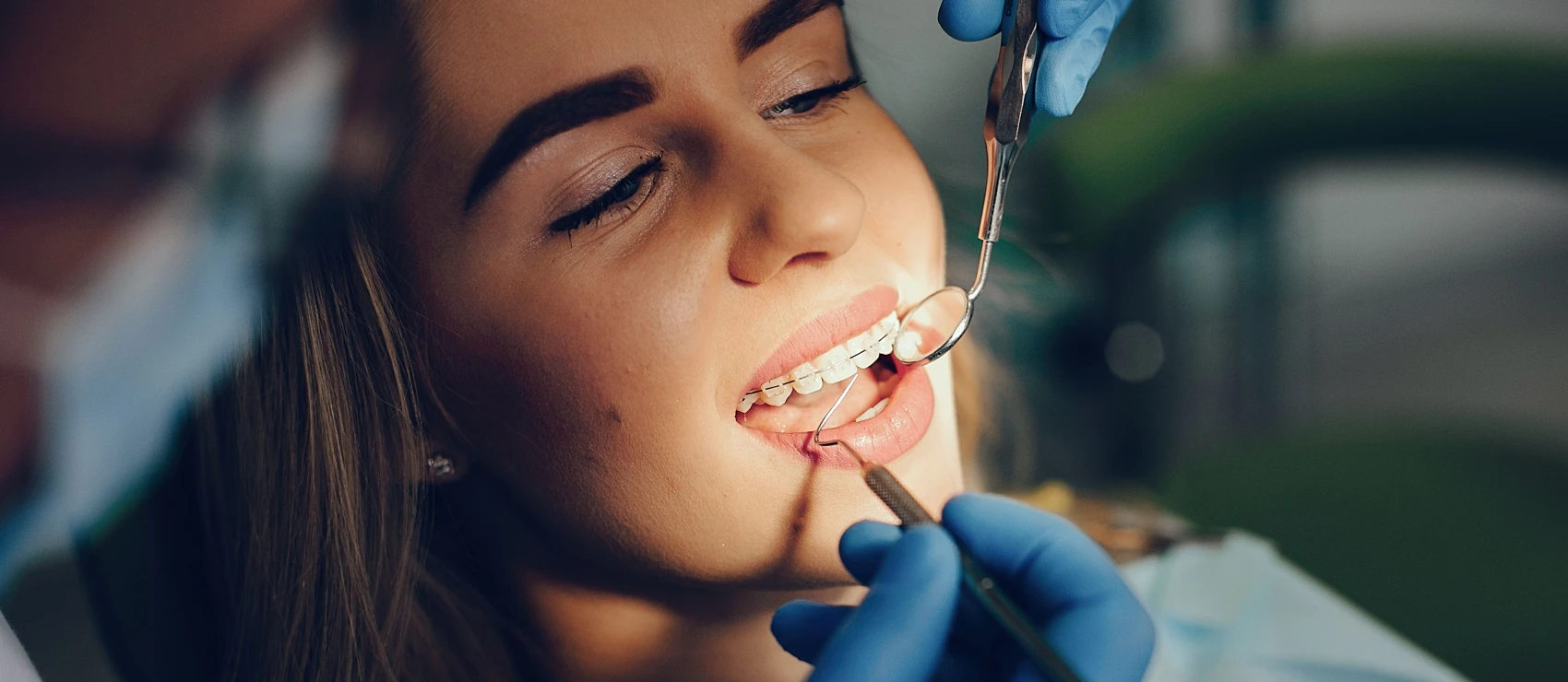 L'orthodontie et le bien-être mental : Boostez votre confiance grâce à un sourire aligné