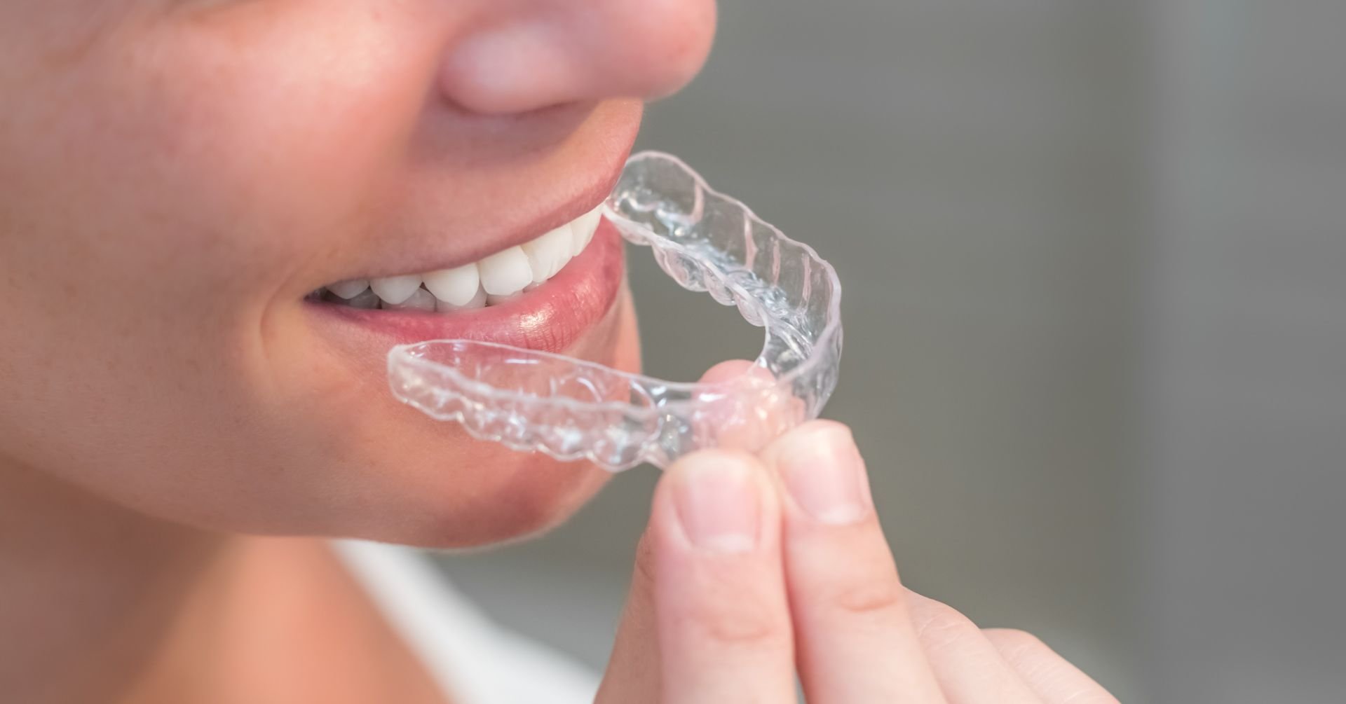 Les nouvelles technologies qui révolutionnent l'orthodontie