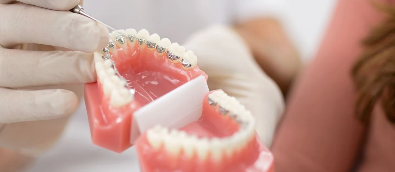 Orthodontie et sport : comment concilier les deux en toute sérénité ?