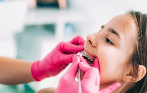 Sourire parfait, pression sociale ? Réflexion sur l’idéal esthétique en orthodontie