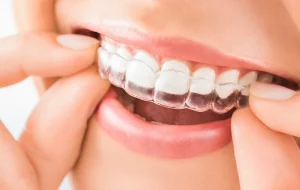 L’évolution des techniques orthodontiques au fil du temps