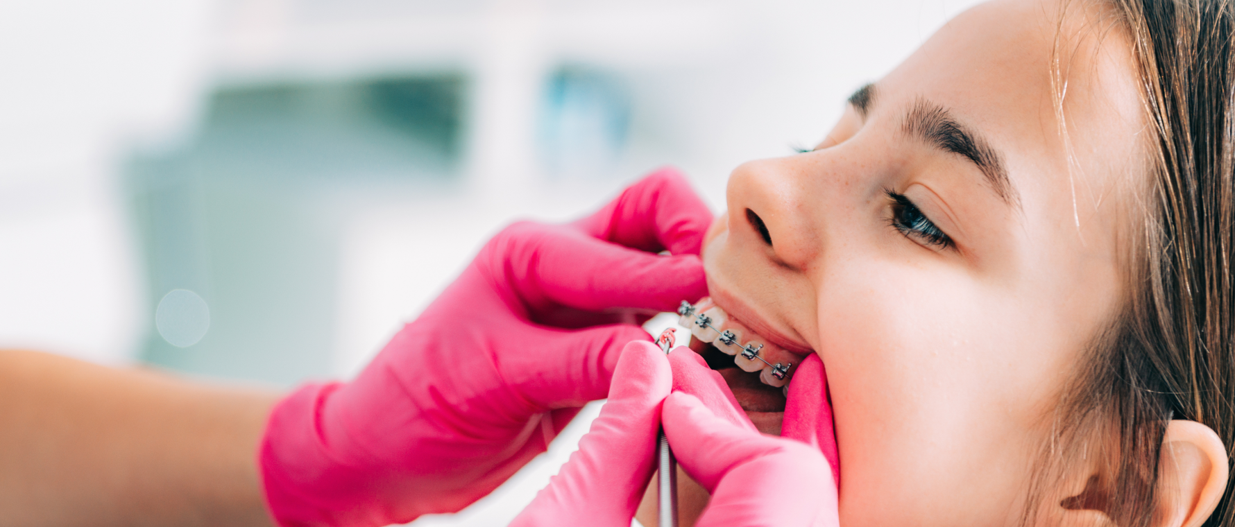 Orthodontie et douleurs : qu’est-ce qui est normal et qu’est-ce qui doit inquiéter ?